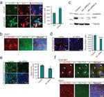 Acetyl-alpha Tubulin (Lys40) Antibody in Immunohistochemistry (IHC)