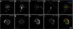 Acetyl-alpha Tubulin (Lys40) Antibody in Immunocytochemistry (ICC/IF)