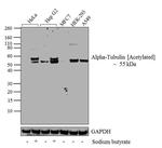 Acetyl-alpha Tubulin (Lys40) Antibody in Western Blot (WB)