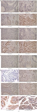 CKS1 Antibody in Immunohistochemistry (IHC)