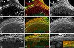 alpha Internexin Antibody in Immunohistochemistry (IHC)