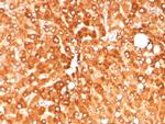 Haptoglobin (HP) Antibody in Immunohistochemistry (Paraffin) (IHC (P))