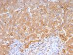 Haptoglobin (HP) Antibody in Immunohistochemistry (Paraffin) (IHC (P))