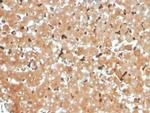 Haptoglobin (HP) Antibody in Immunohistochemistry (Paraffin) (IHC (P))