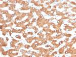 Haptoglobin (HP) Antibody in Immunohistochemistry (Paraffin) (IHC (P))