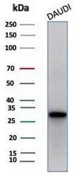 Haptoglobin (HP) Antibody in Western Blot (WB)