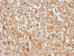 Haptoglobin (HP) Antibody in Immunohistochemistry (Paraffin) (IHC (P))