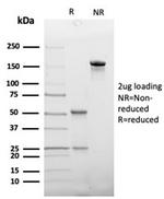 Haptoglobin (HP) Antibody in Immunoelectrophoresis (IE)