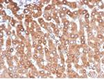 Haptoglobin (HP) Antibody in Immunohistochemistry (Paraffin) (IHC (P))