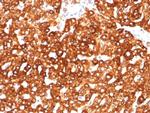 Haptoglobin (HP) Antibody in Immunohistochemistry (Paraffin) (IHC (P))