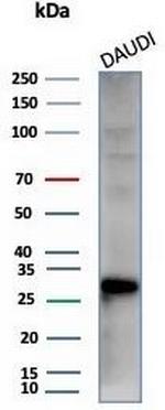 Haptoglobin (HP) Antibody in Western Blot (WB)