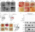 P-cadherin Antibody in Immunohistochemistry (IHC)