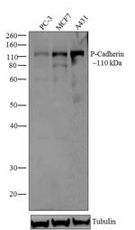 P-cadherin Antibody in Western Blot (WB)