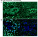 PTBP1 Antibody in Immunohistochemistry (IHC)