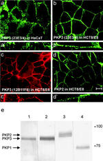 PKP1 Antibody in Western Blot (WB)