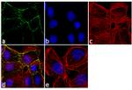 PKP1 Antibody in Immunocytochemistry (ICC/IF)