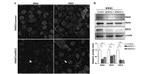 Desmocollin 2/3 Antibody in Western Blot, Immunocytochemistry (WB, ICC/IF)