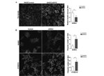 Desmocollin 2/3 Antibody in Immunocytochemistry (ICC/IF)