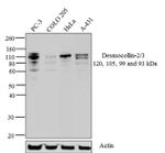 Desmocollin 2/3 Antibody in Western Blot (WB)