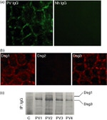 Desmoglein 3 Antibody in Western Blot, Immunocytochemistry (WB, ICC/IF)