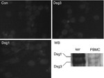 Desmoglein 3 Antibody in Western Blot, Immunocytochemistry (WB, ICC/IF)