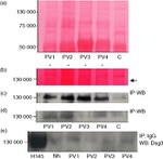 Desmoglein 3 Antibody in Western Blot (WB)