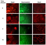 Desmoglein 3 Antibody in Immunocytochemistry (ICC/IF)