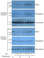 Desmoglein 3 Antibody in Western Blot (WB)