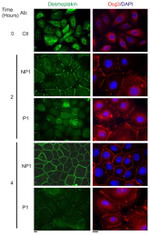 Desmoglein 3 Antibody in Immunocytochemistry (ICC/IF)