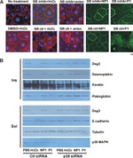 Desmoglein 3 Antibody in Immunocytochemistry (ICC/IF)