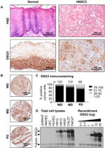 Desmoglein 3 Antibody in Immunohistochemistry (IHC)