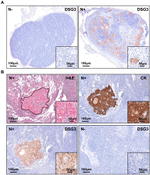 Desmoglein 3 Antibody in Immunohistochemistry (IHC)