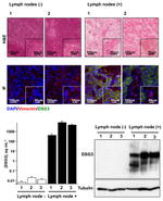 Desmoglein 3 Antibody in Western Blot, Immunohistochemistry (WB, IHC)