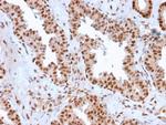 APEX Nuclease I Antibody in Immunohistochemistry (Paraffin) (IHC (P))