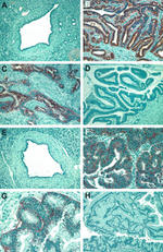 CXCR4 Antibody in Immunohistochemistry (Paraffin) (IHC (P))