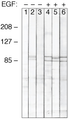 Phospho-STAT1 (Tyr701) Antibody in Western Blot (WB)