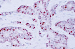 Cyclin D1 Antibody in Immunohistochemistry (IHC)