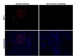 ZO-1 Antibody in Immunohistochemistry (Paraffin) (IHC (P))