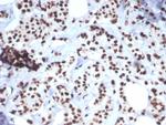 Heat shock 70 kDa protein 1B (HSPA1B) Antibody in Immunohistochemistry (Paraffin) (IHC (P))