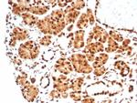 Heat shock 70 kDa protein 1B (HSPA1B) Antibody in Immunohistochemistry (Paraffin) (IHC (P))