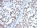 Heat shock 70 kDa protein 1B (HSPA1B) Antibody in Immunohistochemistry (Paraffin) (IHC (P))