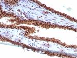 Heat shock 70 kDa protein 1B (HSPA1B) Antibody in Immunohistochemistry (Paraffin) (IHC (P))