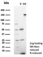 Heat shock 70 kDa protein 1B (HSPA1B) Antibody in SDS-PAGE (SDS-PAGE)