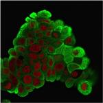 HSP27 (Heat Shock Protein 27) Antibody in Immunocytochemistry (ICC/IF)