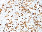 HSP27 (Heat Shock Protein 27) Antibody in Immunohistochemistry (Paraffin) (IHC (P))