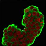 HSP27 (Heat Shock Protein 27) Antibody in Immunocytochemistry (ICC/IF)