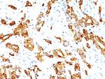 HSP27 (Heat Shock Protein 27) Antibody in Immunohistochemistry (Paraffin) (IHC (P))