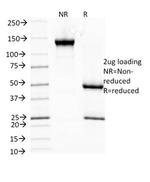 HSP27 (Heat Shock Protein 27) Antibody in SDS-PAGE (SDS-PAGE)