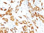 HSP27 (Heat Shock Protein 27) Antibody in Immunohistochemistry (Paraffin) (IHC (P))