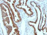 HSP27 (Heat Shock Protein 27) Antibody in Immunohistochemistry (Paraffin) (IHC (P))